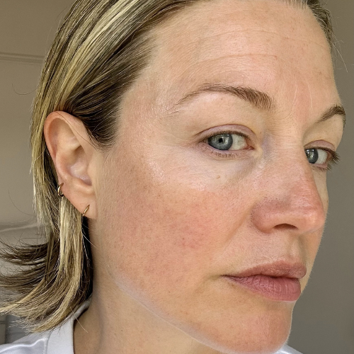 1 Serum, 4 Weeks!  Watch Alexis Foreman's Eye Activator Journey