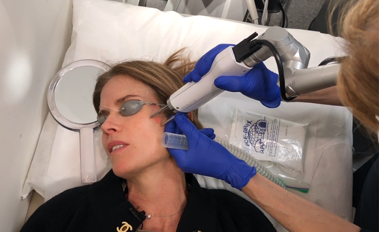 Spring Clean Your Skin! Watch Gucci Zap Dark Spots at a Top Dermatologist's Office